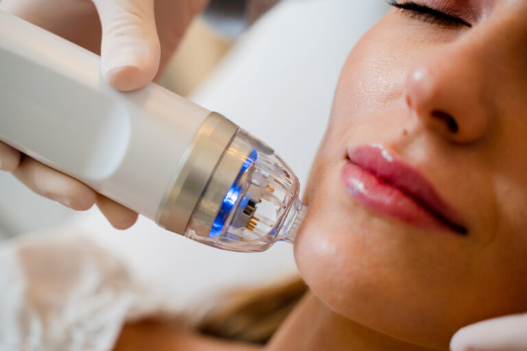 Inside RF Microneedling: Deeper Collagen Stimulation, Deeper Risks
