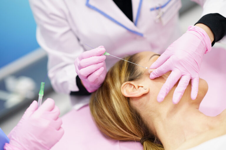 Thread Lifts: How Long Do Results Really Last?
