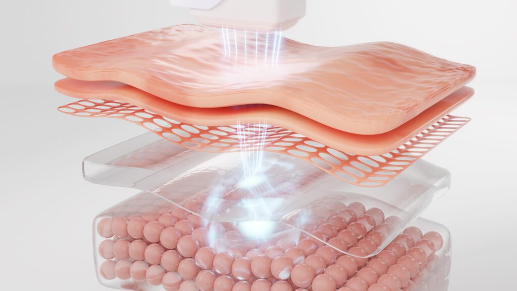 An illustration for laser skincare treatment.