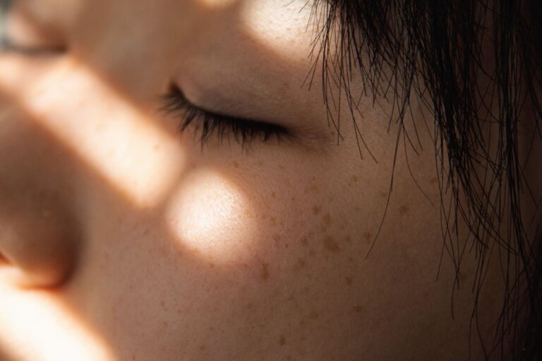 Woman with sun spots, closing her eyes under the sun